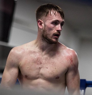 ハリー・スカーフ