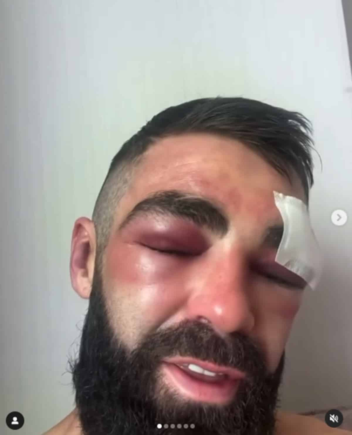 画像: ボクシングアワード: 2024 年の最も勇気あるパフォーマンスのトップ 5 をカウントダウン